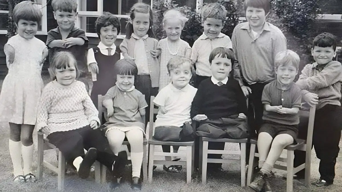 Thalidomide: İnsanlığın Sağlık İçin Ödediği Acı Bir Bedel